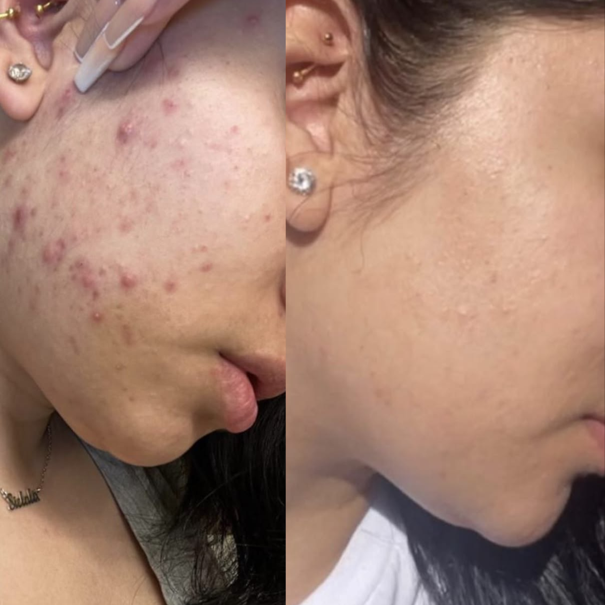 Collagen Jelly Cream