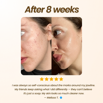 Kojic Acid Soap
